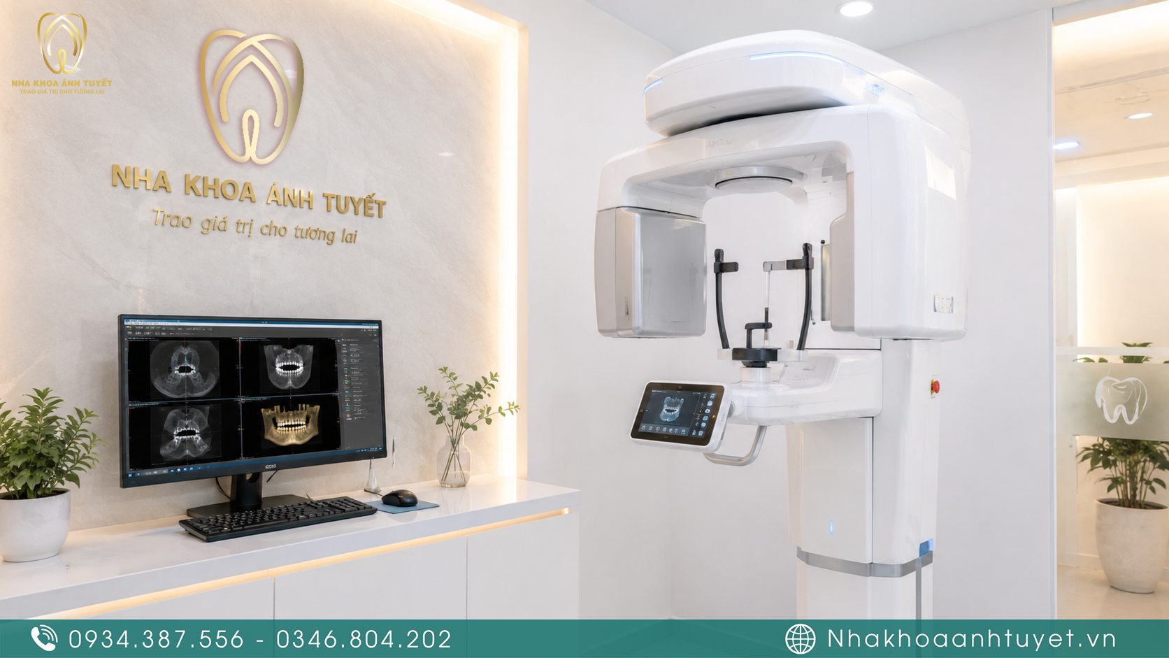 Hệ thống máy chụp phim CT Cone Beam 3D khảo sát xương hàm