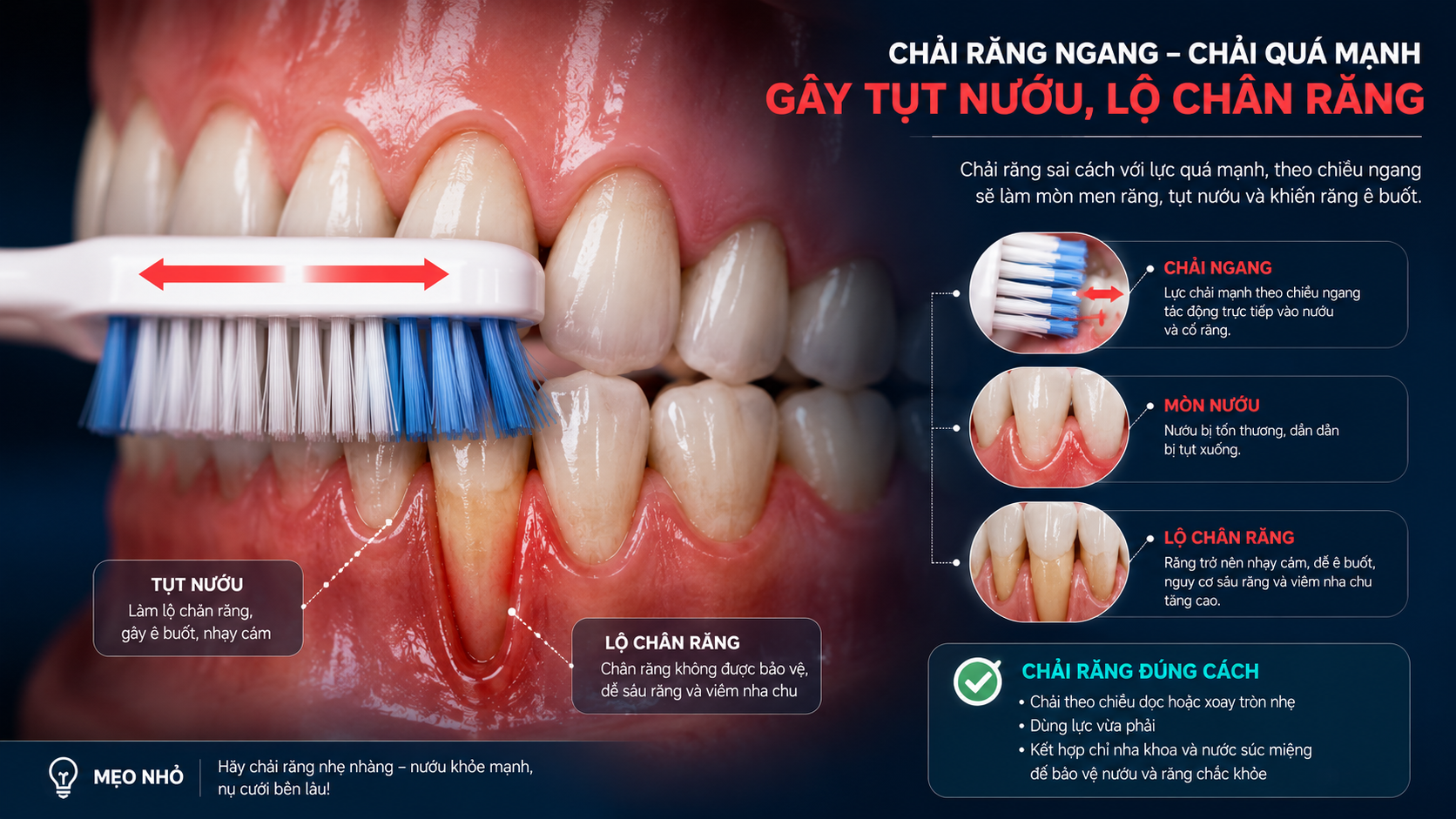 Chải răng ngang quá mạnh là nguyên nhân hàng đầu gây ra tổn thương nướu