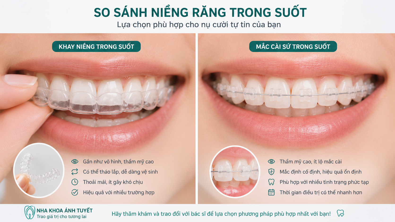 Giải pháp mắc cài sứ và khay trong suốt giúp đảm bảo thẩm mỹ khi giao tiếp