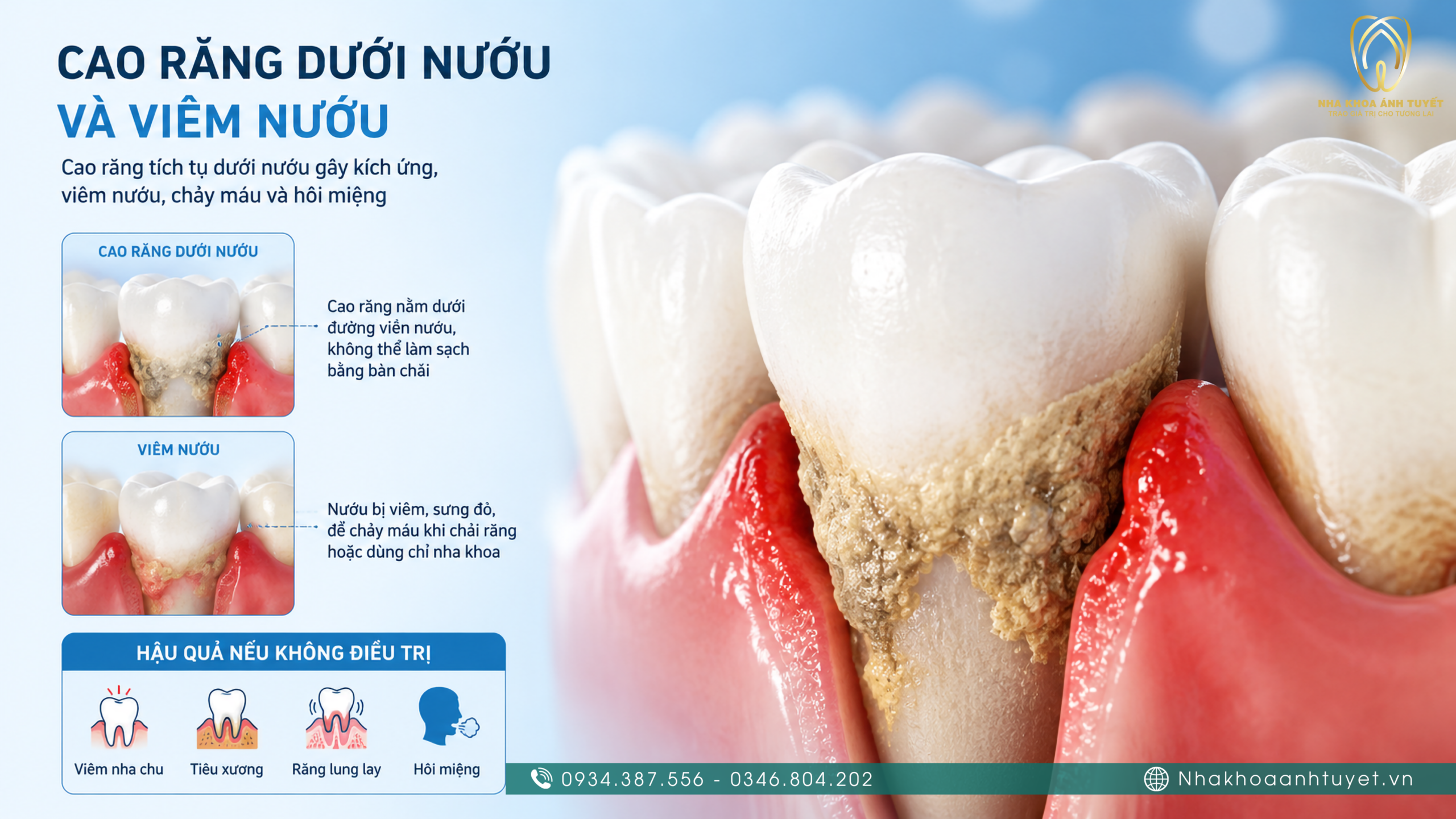 Dùng kẹo ngậm chỉ che giấu tạm thời nguyên nhân hôi miệng