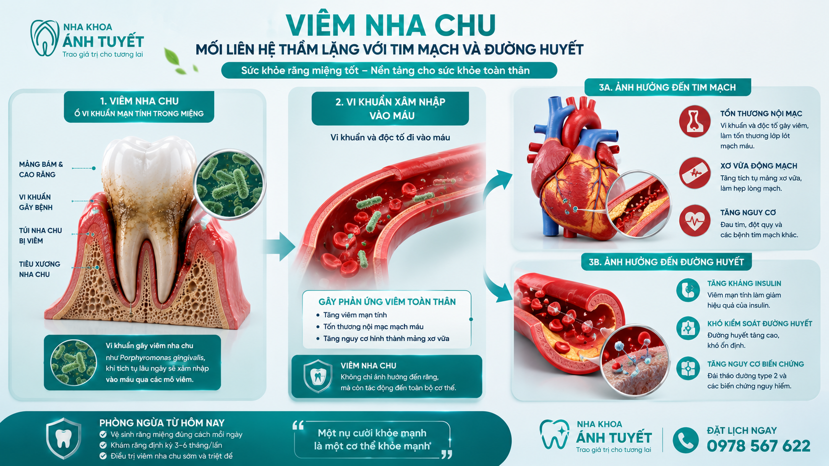Mối liên hệ giữa biến chứng bệnh viêm nha chu với bệnh tim mạch và tiểu đường