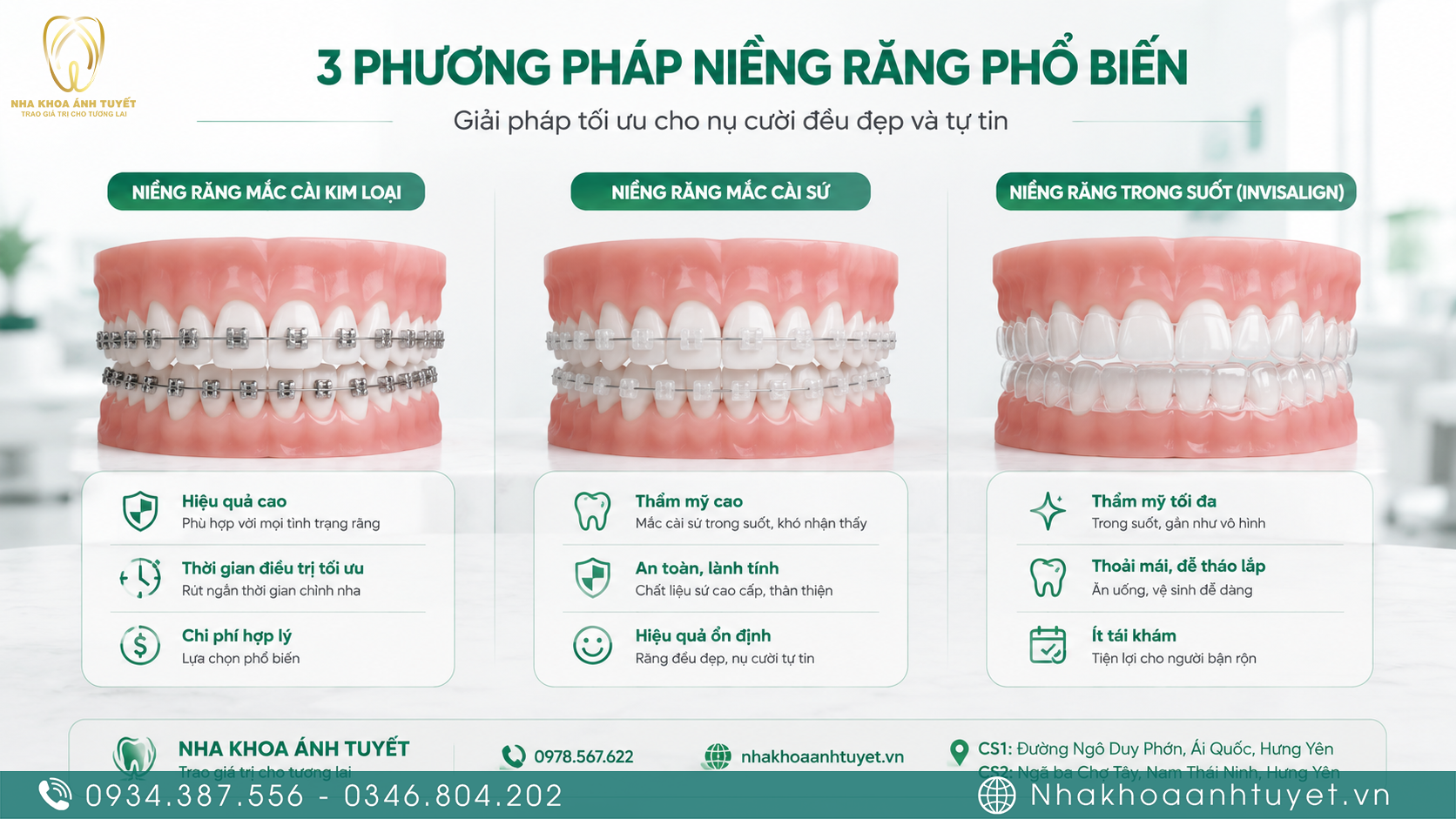 So sánh các phương pháp chỉnh nha phổ biến hiện nay
