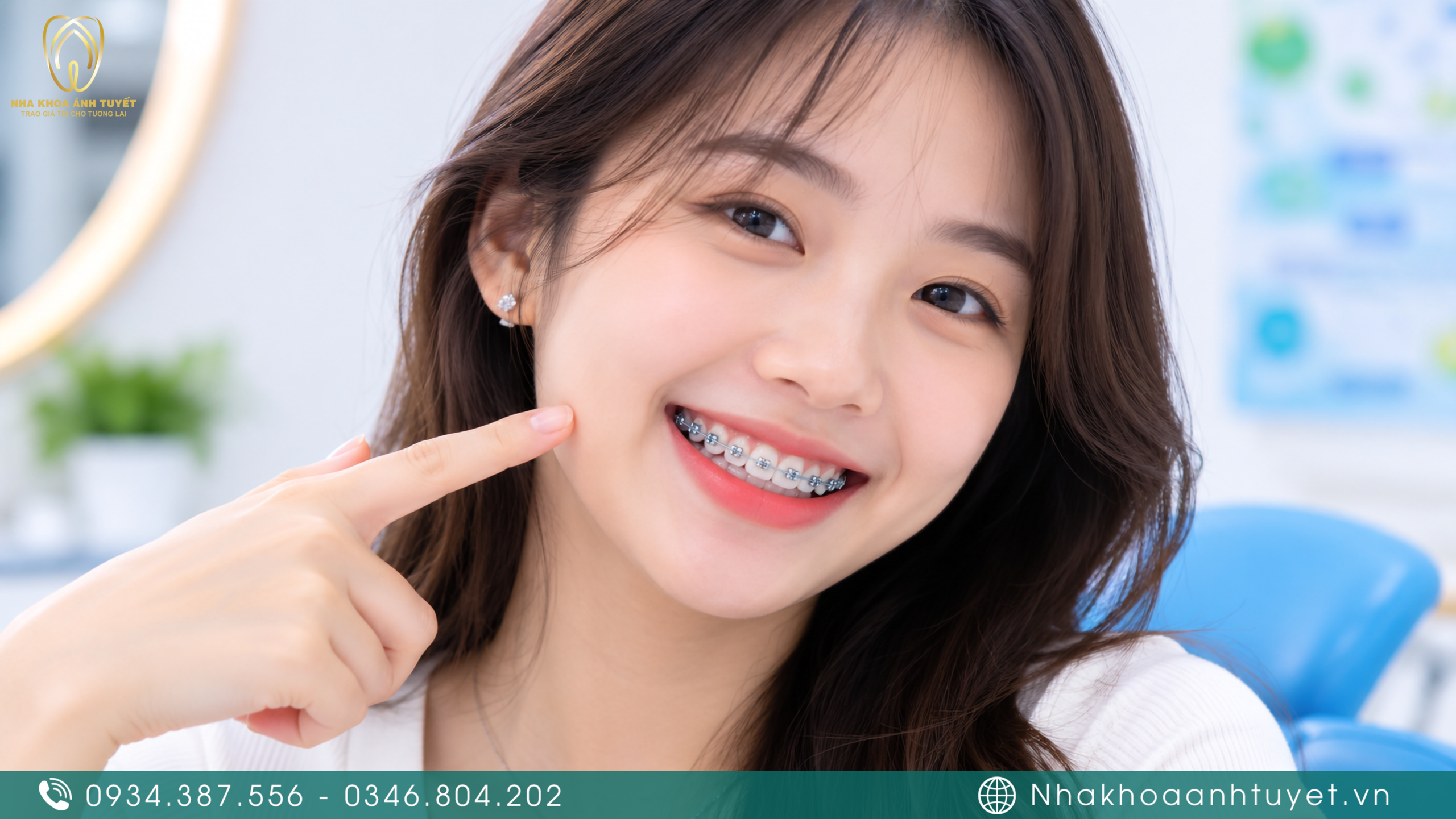 Cận cảnh hệ thống mắc cài Titan trên hàm răng