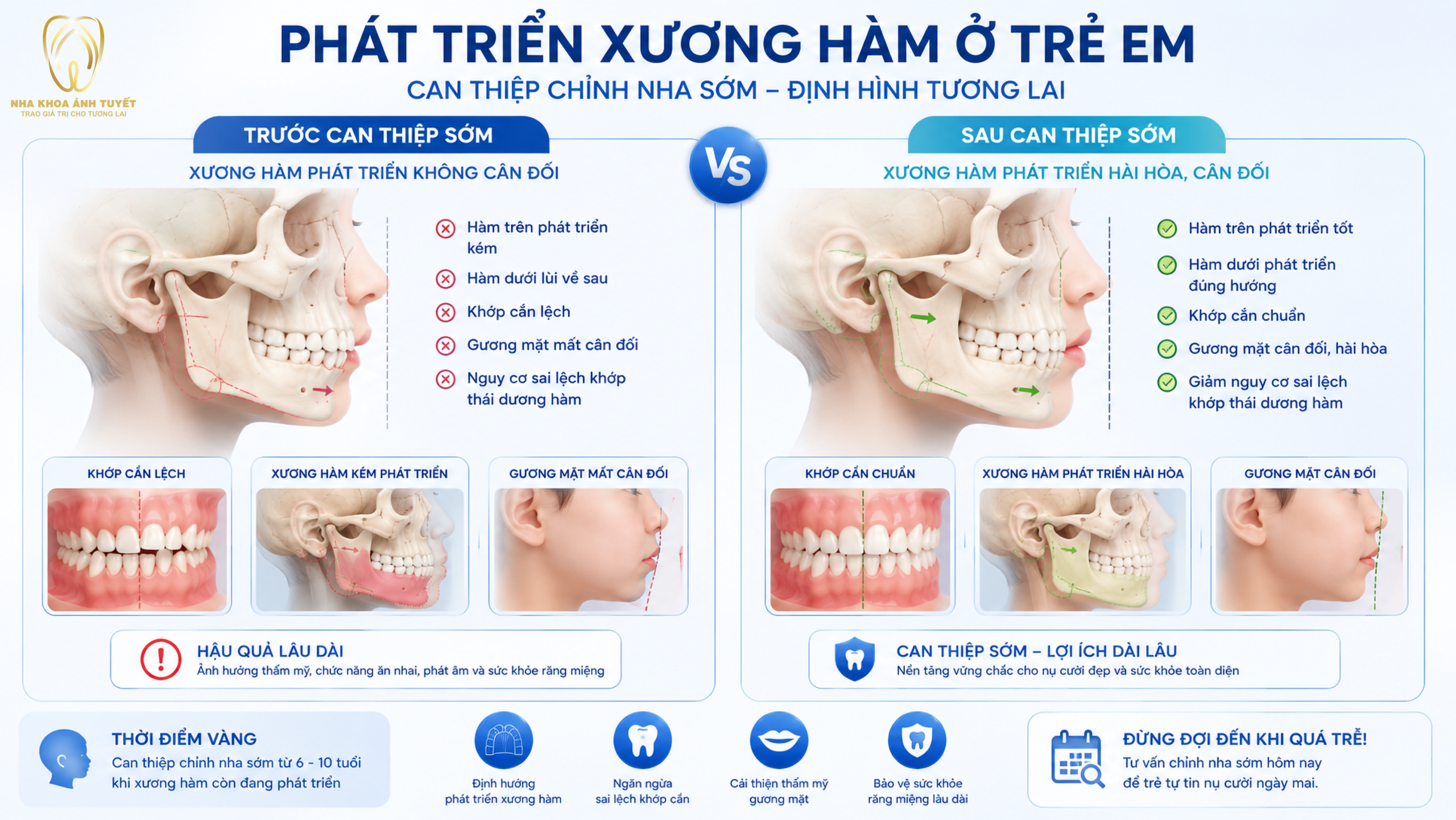 Sự phát triển xương hàm hài hòa nhờ can thiệp niềng răng cho trẻ em sớm