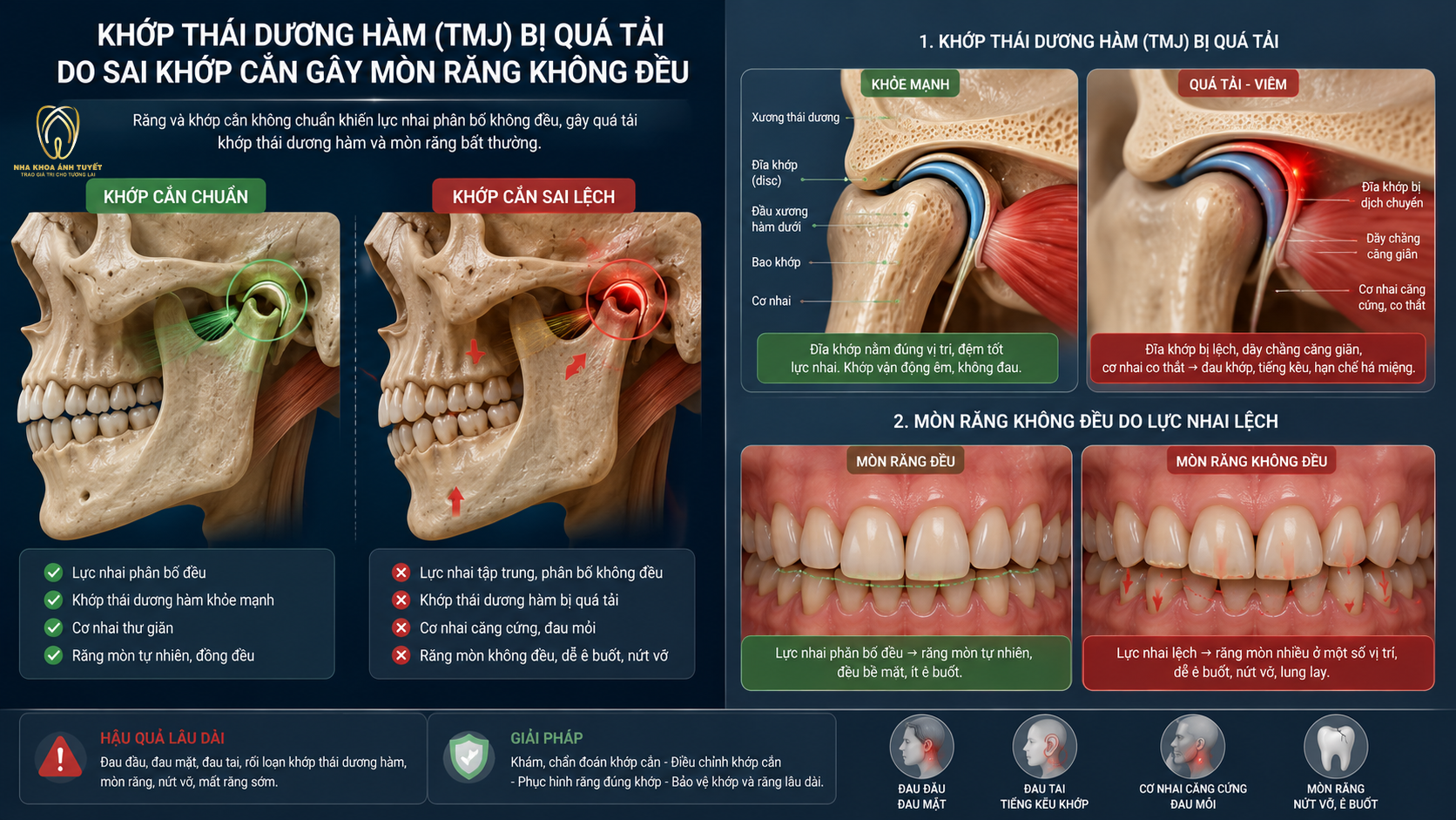 Sơ đồ y khoa biến chứng sai lệch khớp cắn và tổn thương khớp thái dương hàm
