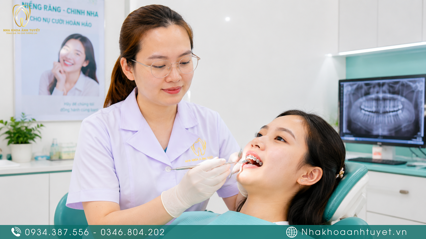 Bác sĩ kiểm tra sự di chuyển của răng trong các đợt tái khám định kỳ