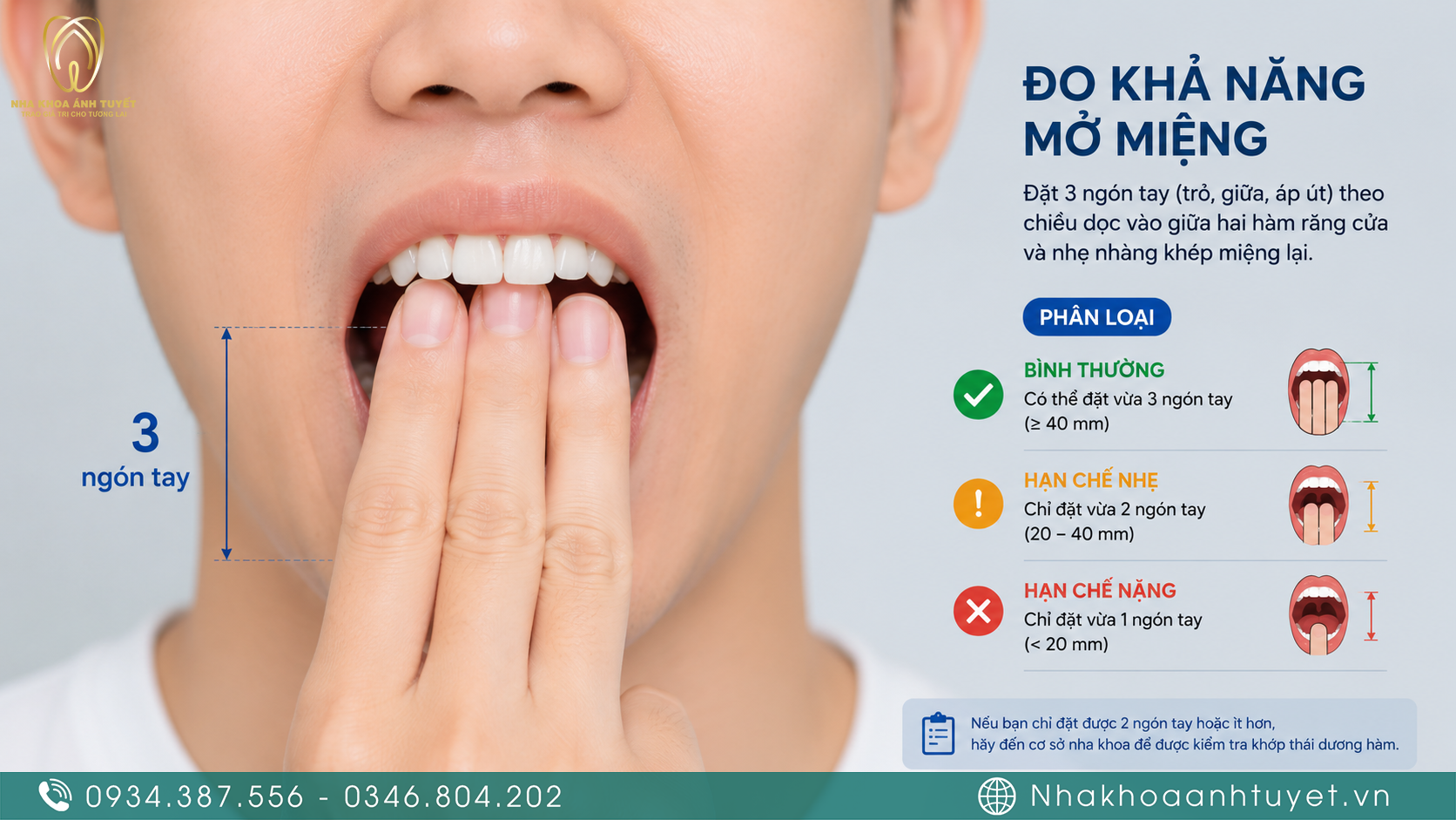 Hướng dẫn cách kiểm tra độ mở rộng của khuôn miệng tại nhà