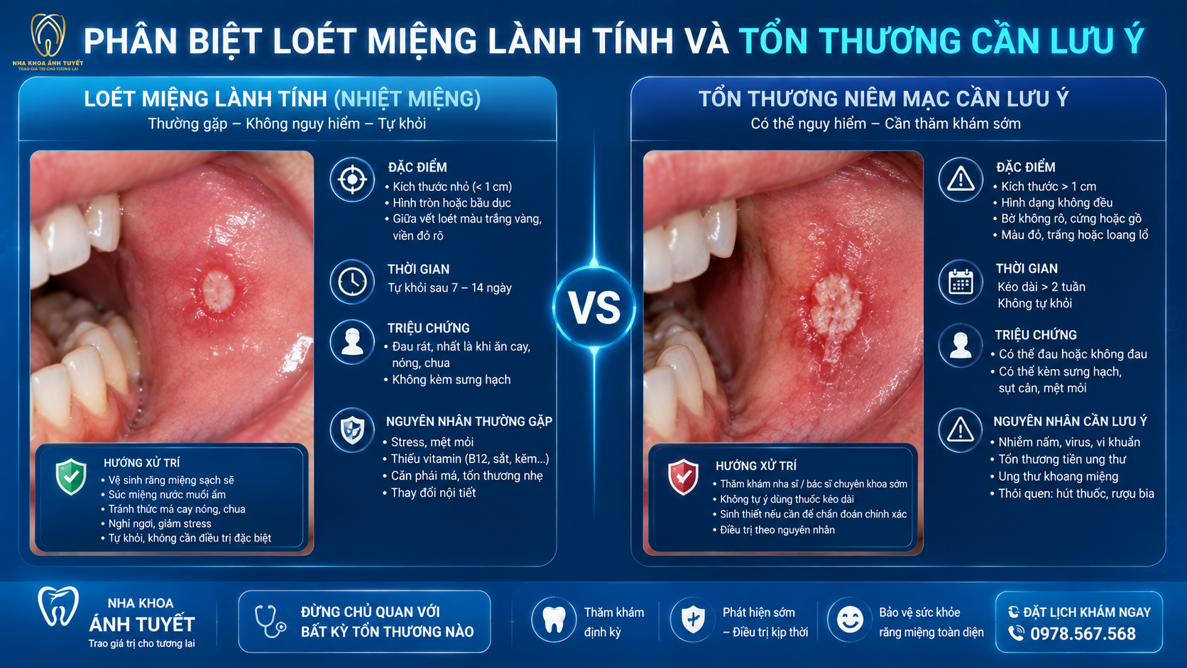 Phân biệt hình thái tổn thương nhiệt miệng thường và vết loét lâu lành