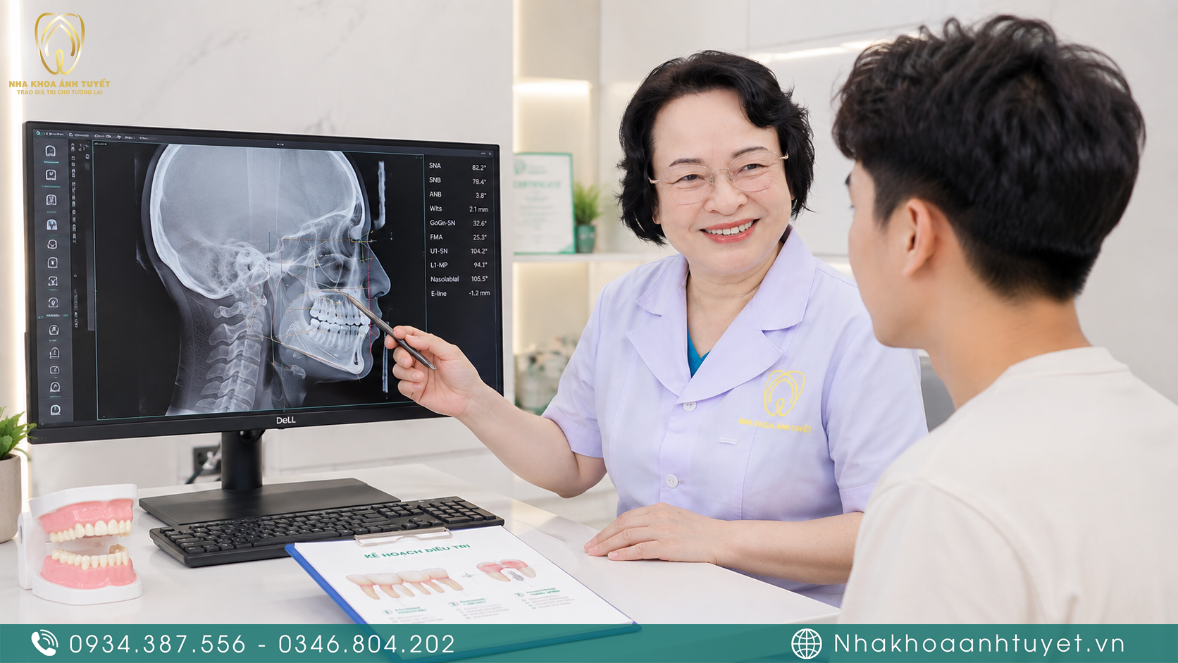 Bác sĩ Nha khoa Ánh Tuyết Thái Bình phân tích khoảng trống hàm trên mô hình 3D