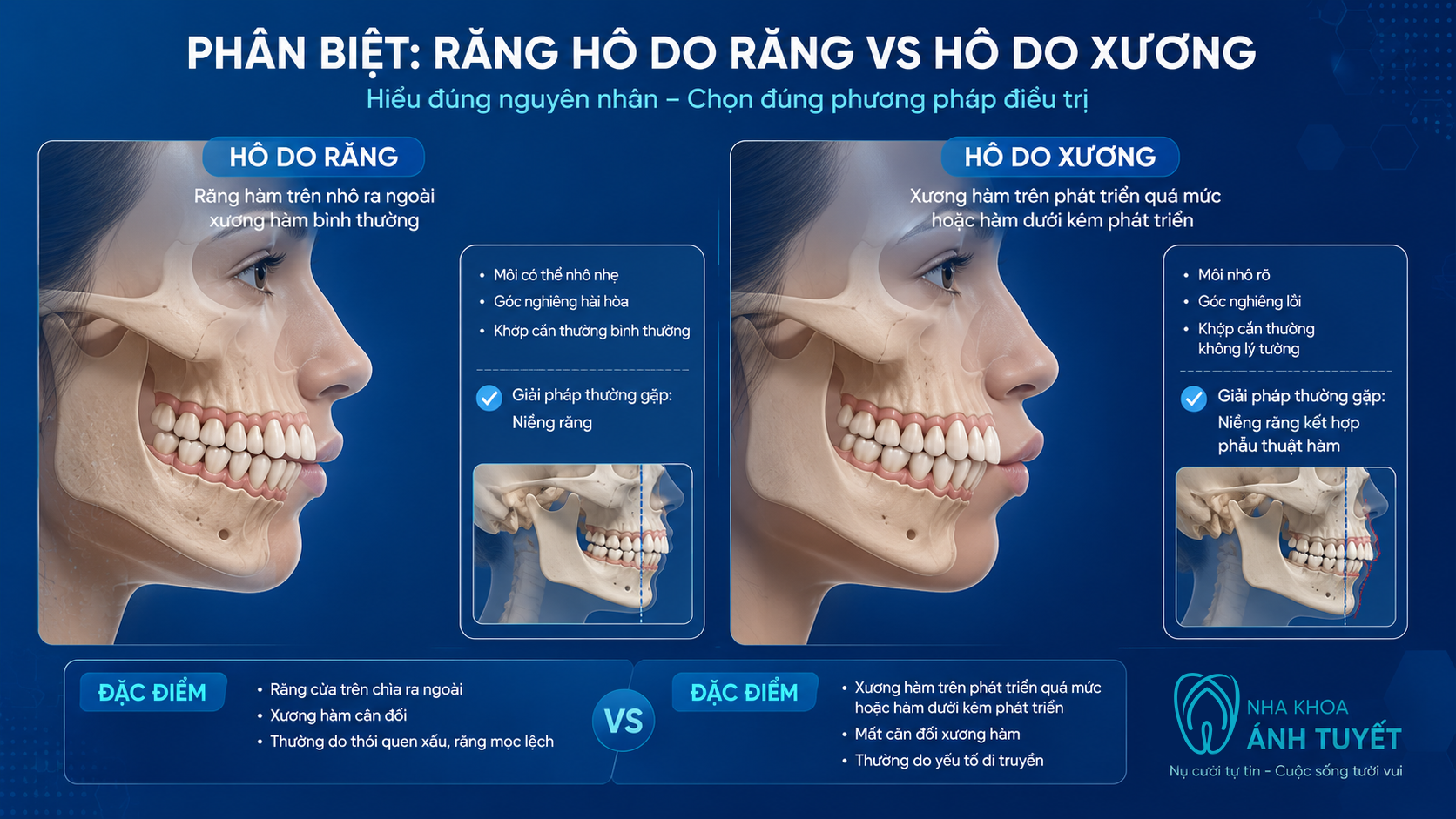 Hình ảnh 3D phân biệt cấu trúc sai lệch khớp cắn do răng và do xương