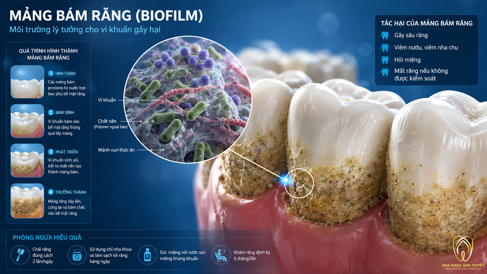 Mô phỏng 3D diễn tiến mảng bám răng hình thành như thế nào trên bề mặt men răng