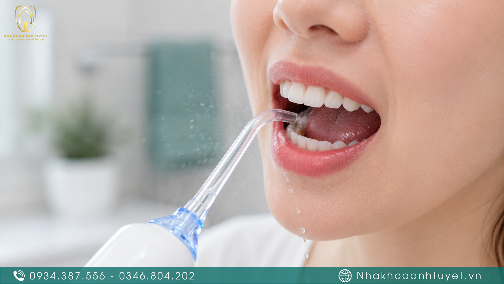 Kỹ thuật sử dụng tăm nước hỗ trợ vệ sinh mảng bám vi khuẩn ở kẽ răng