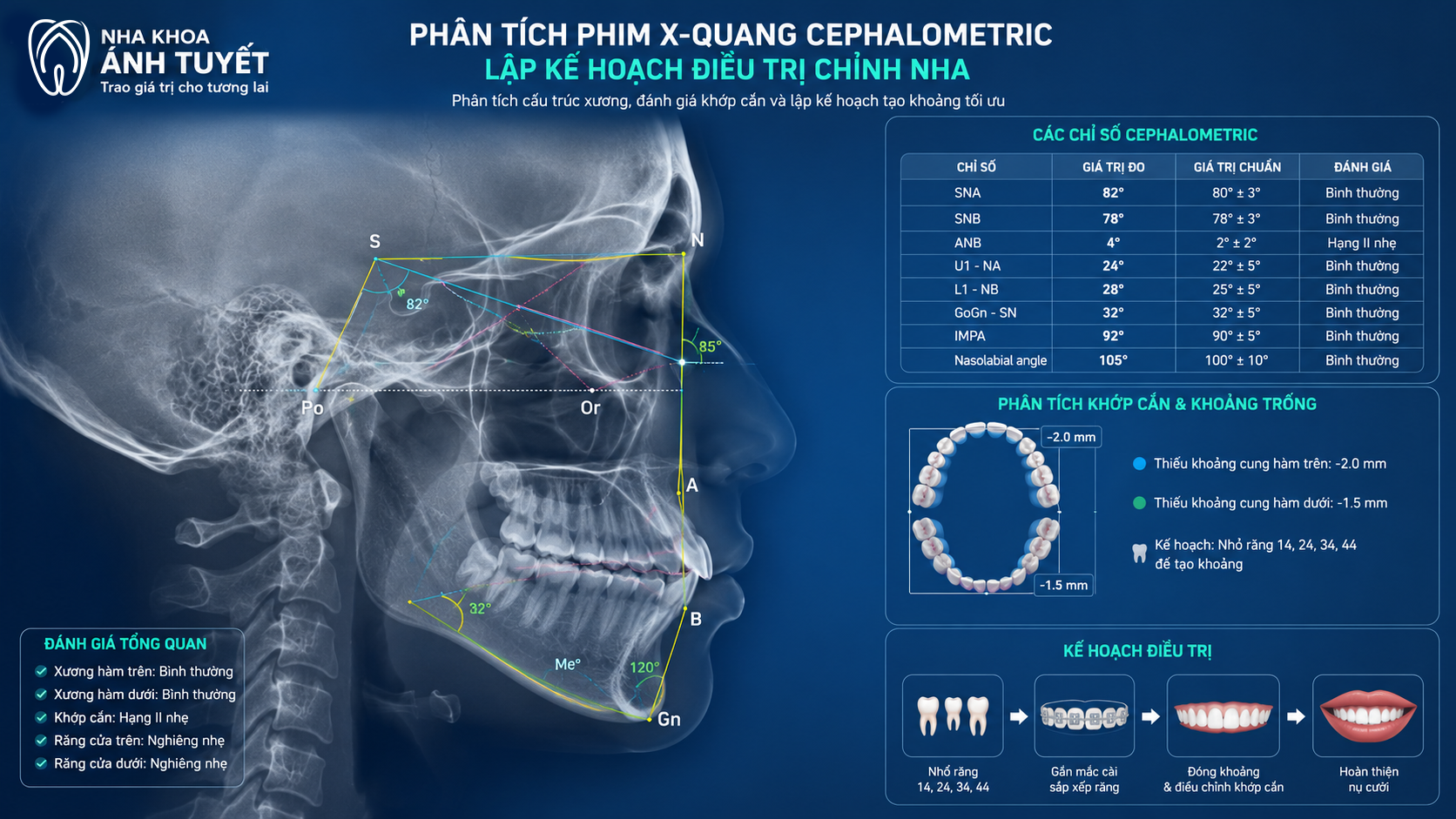 Mô phỏng 3D phân tích khoảng trống trên phim đo sọ chỉnh nha
