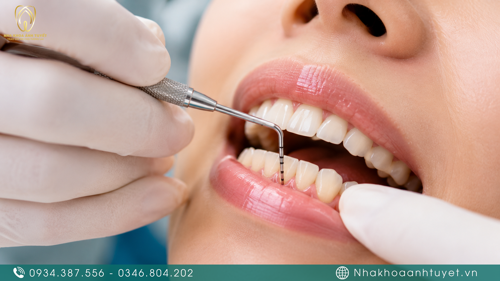 Bác sĩ chuyên khoa đo độ lung lay của răng bằng dụng cụ nha khoa