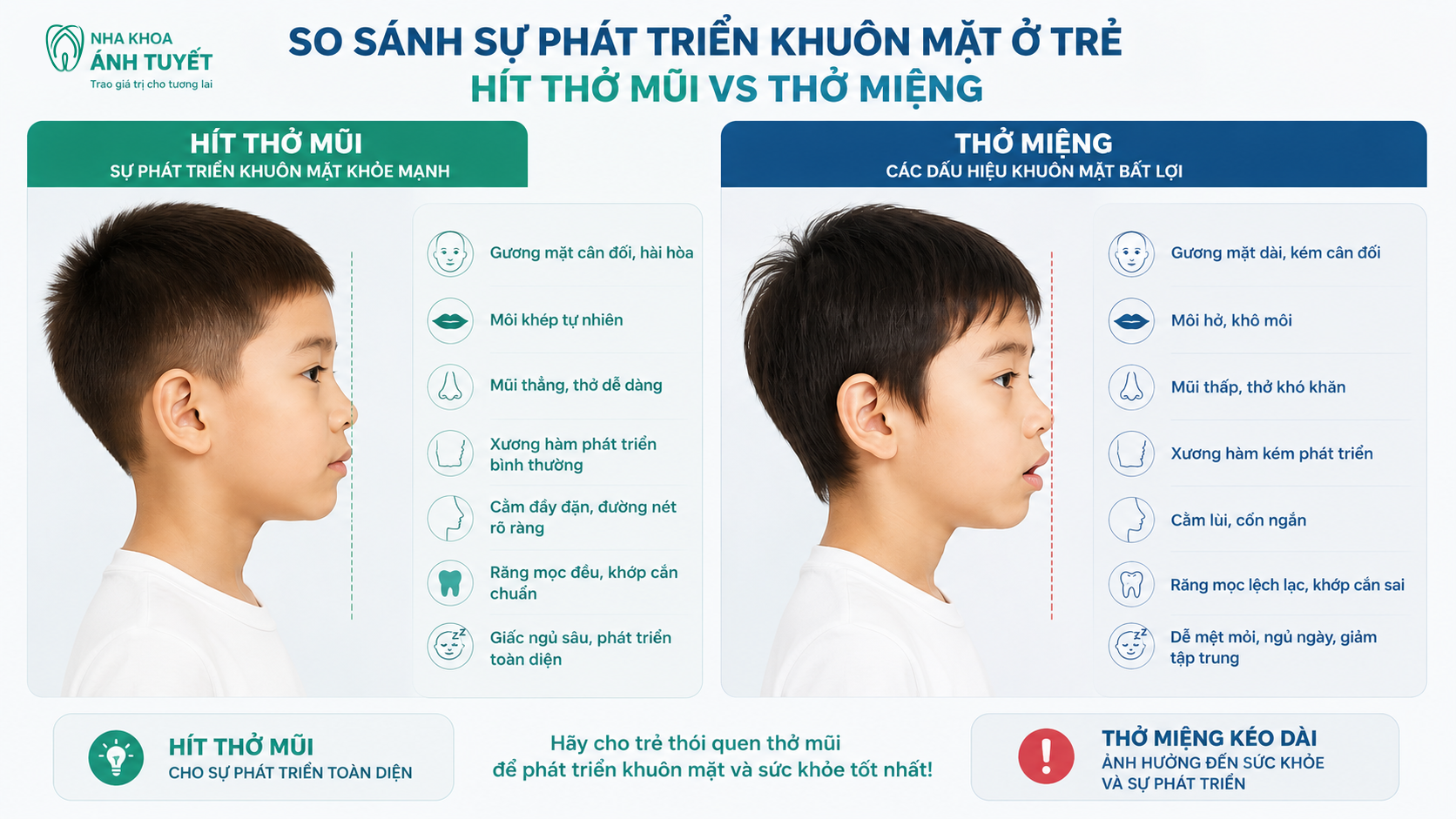 Hình ảnh so sánh sự thay đổi khuôn mặt của trẻ do thói quen thở miệng và mút tay kéo dài
