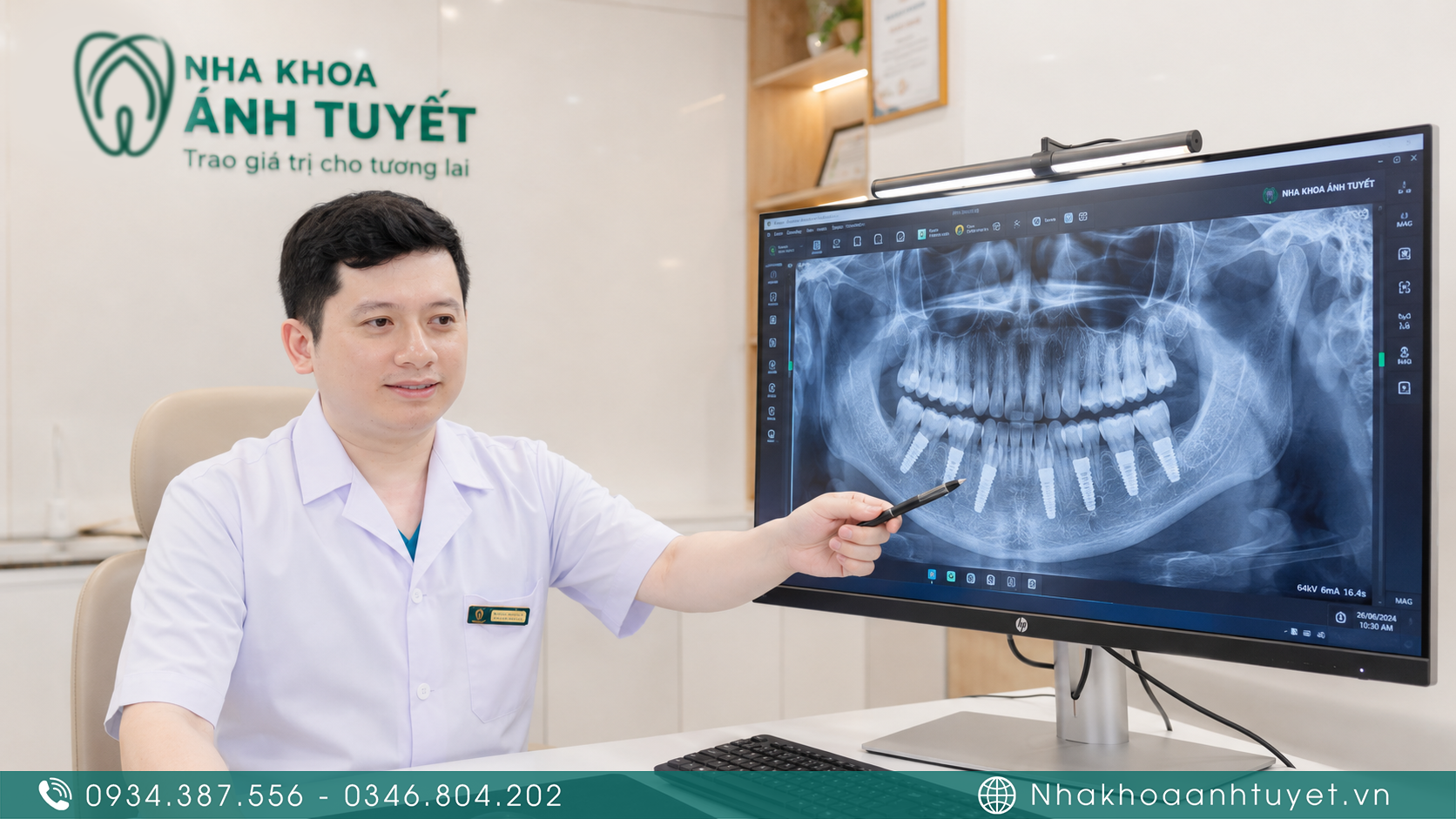 Bác sĩ kiểm tra phim X-quang định kỳ đánh giá độ tích hợp xương quanh trụ Implant