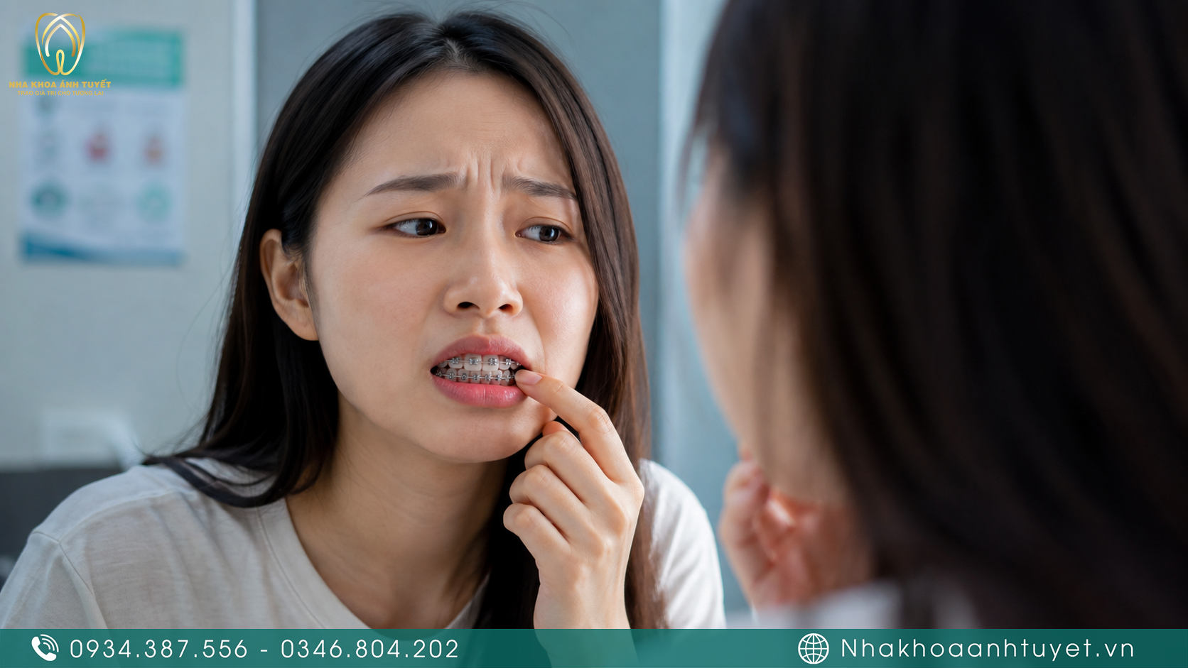 Hình ảnh bệnh nhân lo lắng vì tác hại của việc chỉnh nha sai kỹ thuật