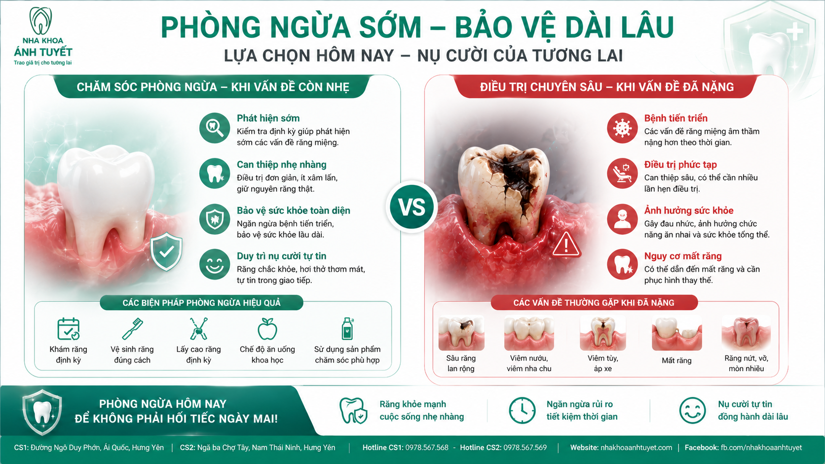 bảng so sánh