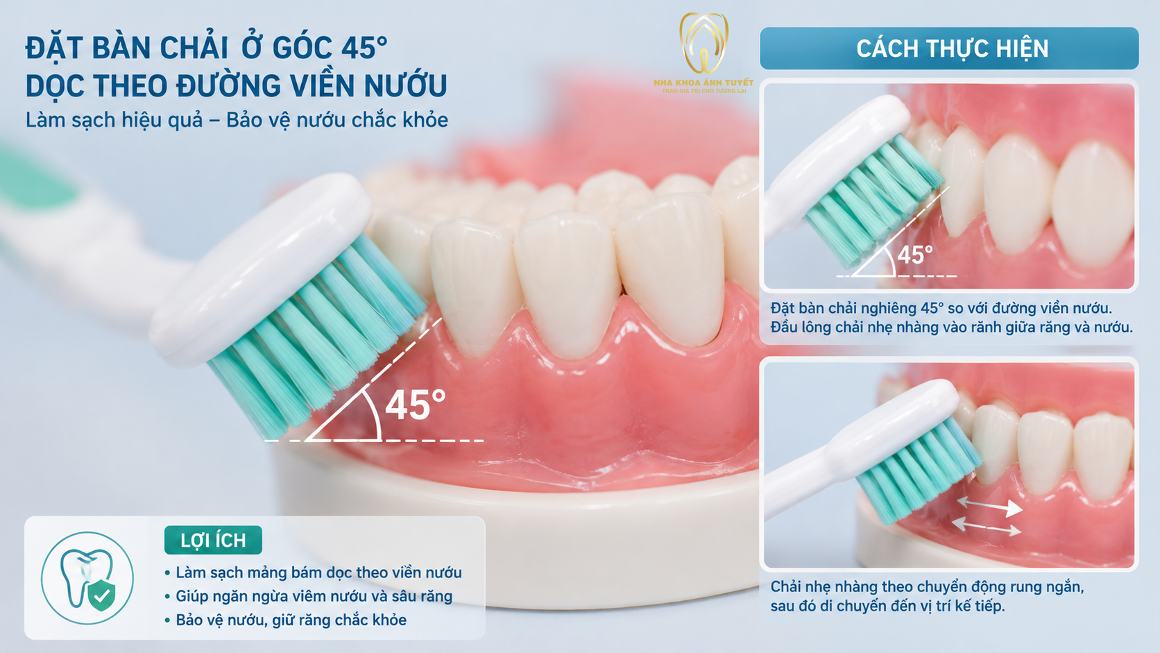 Hướng dẫn góc đặt bàn chải 45 độ chuẩn Y khoa trong quy trình vệ sinh răng miệng