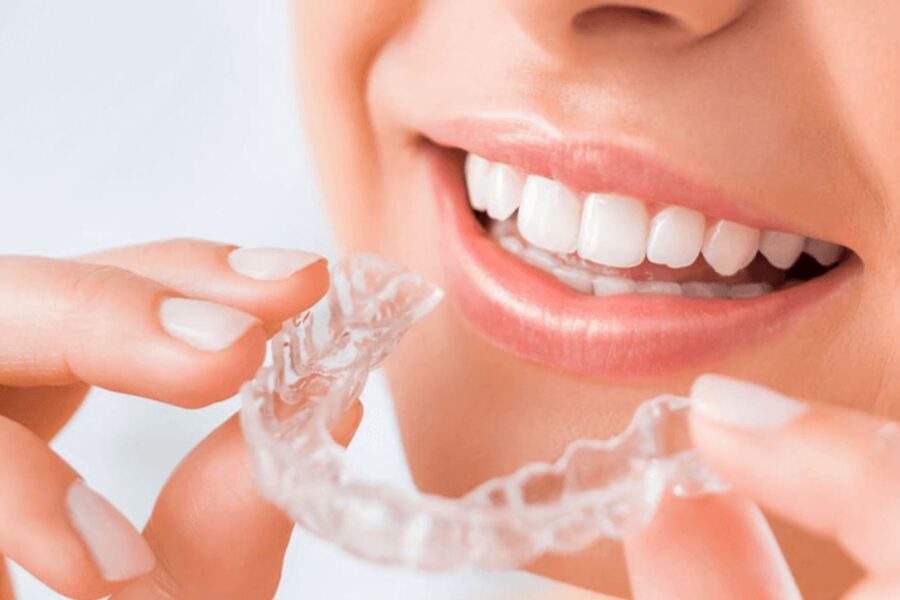 Niềng răng trong suốt Invisalign là gì?