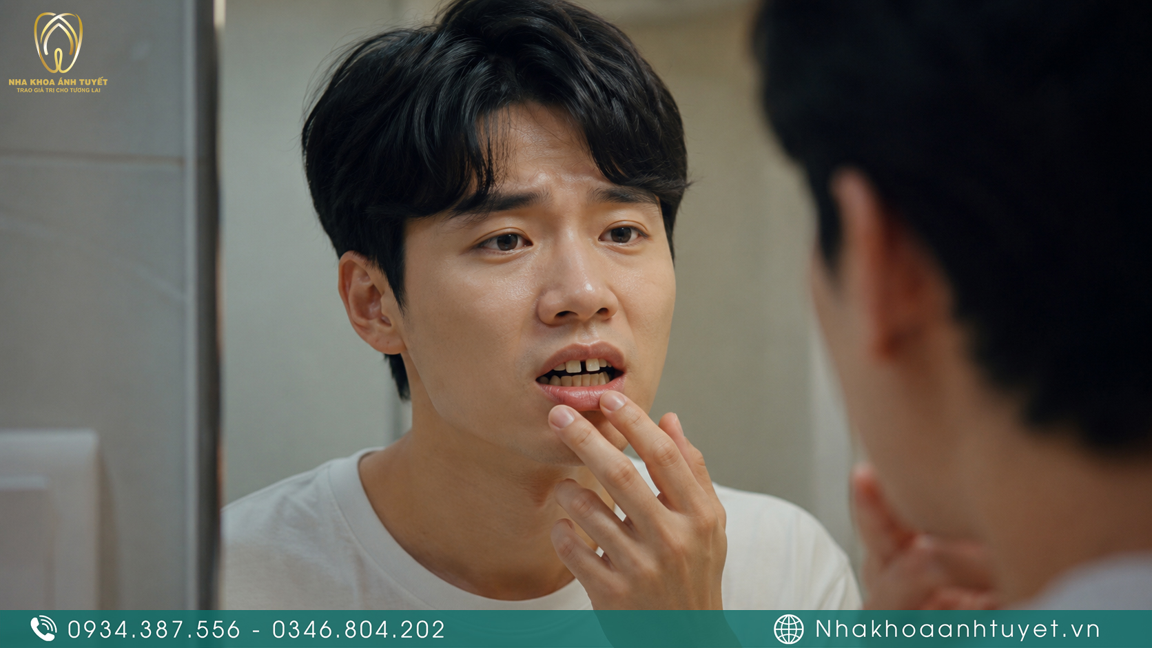 Bệnh nhân quan sát khoảng hở giữa các răng cửa và băn khoăn tìm giải pháp