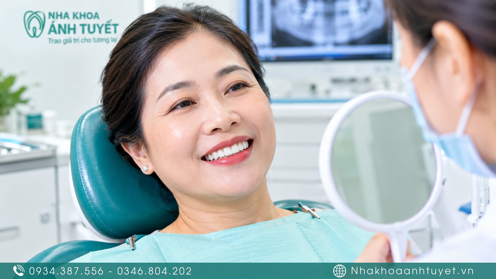 Kết quả phục hình thành công bằng phương pháp implant nâng cầu răng