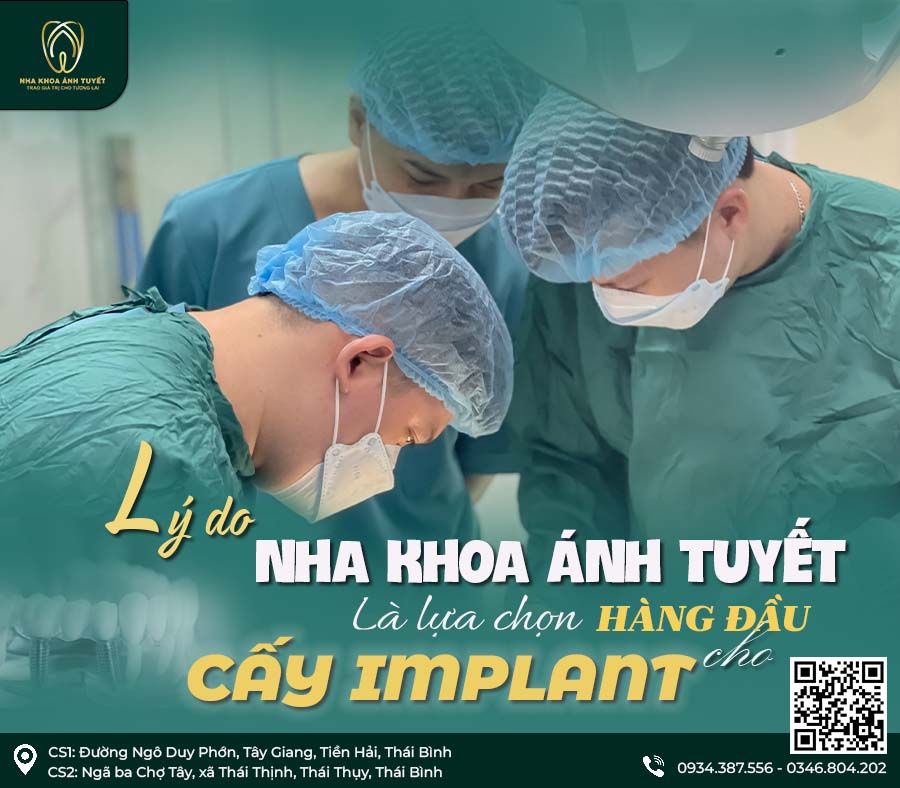 cấy ghép implant là gì