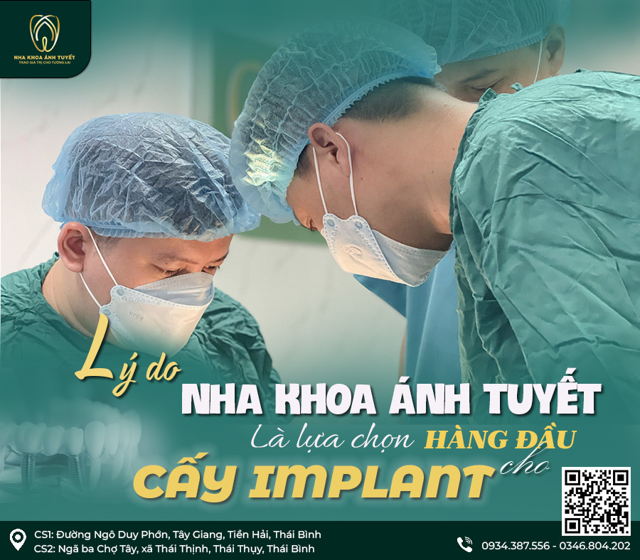 Nha khoa Ánh Tuyết, địa chỉ trồng răng Implant uy tín tại Thái Bình