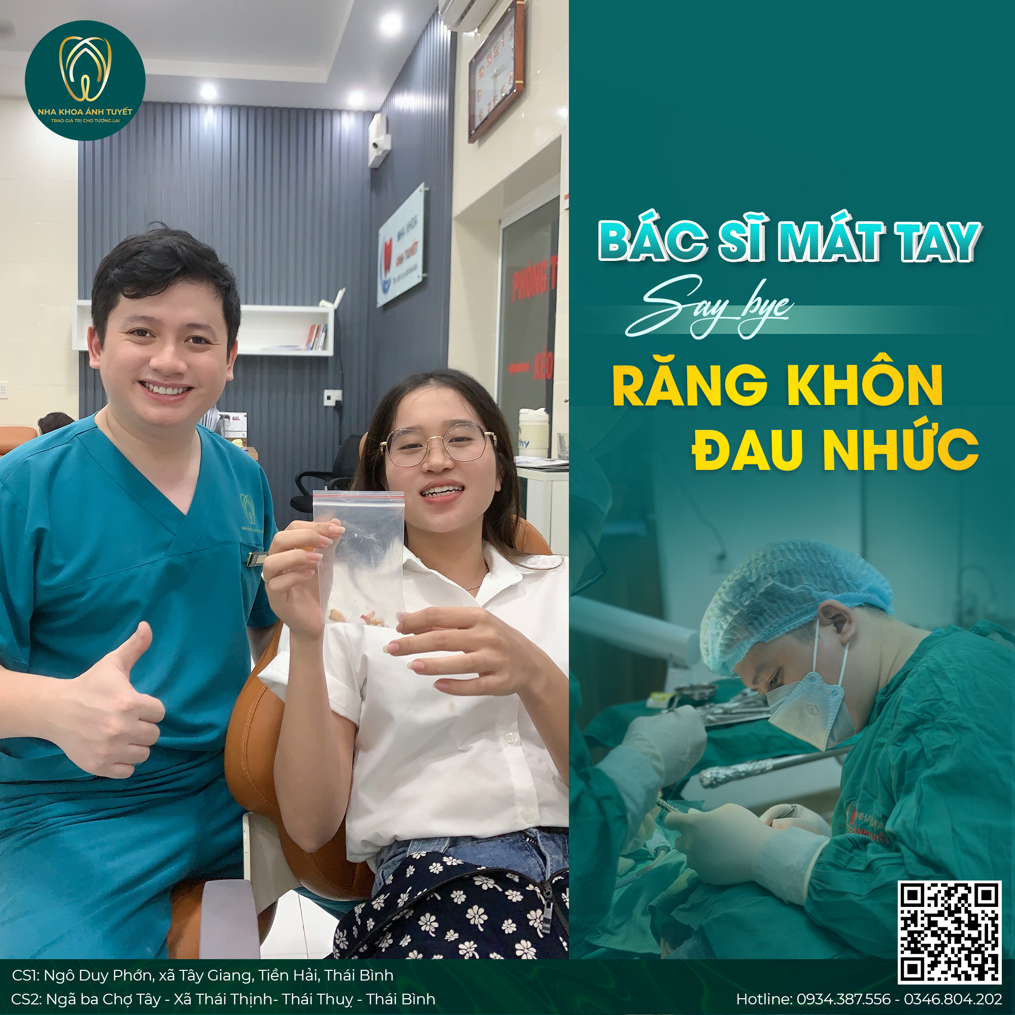 nhổ răng khôn không đau tại Thái Bình