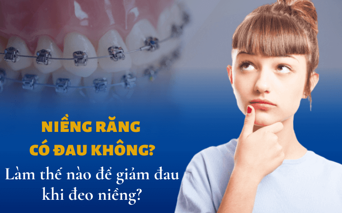 nieng răng ở thái bình