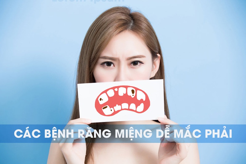 bệnh lý răng miệng và cách phòng ngừa