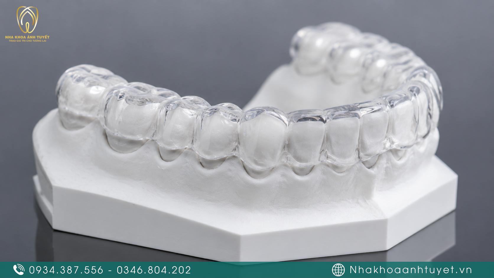 Máng chống nghiến trong suốt giúp bảo vệ bề mặt răng