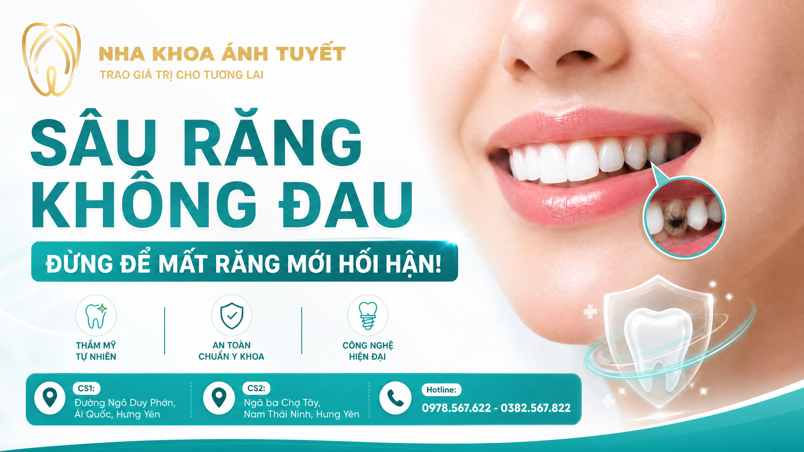"Dấu hiệu sâu răng không đau"