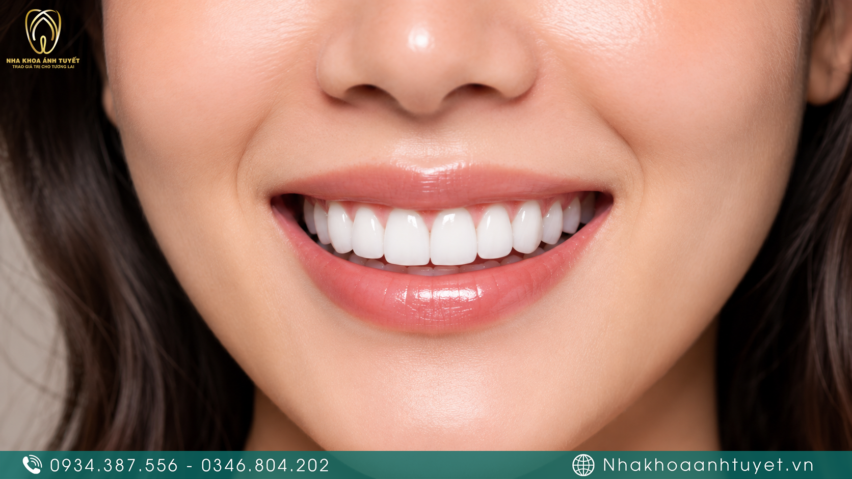 Phục hình nụ cười rạng rỡ bằng chất liệu răng toàn sứ sinh học